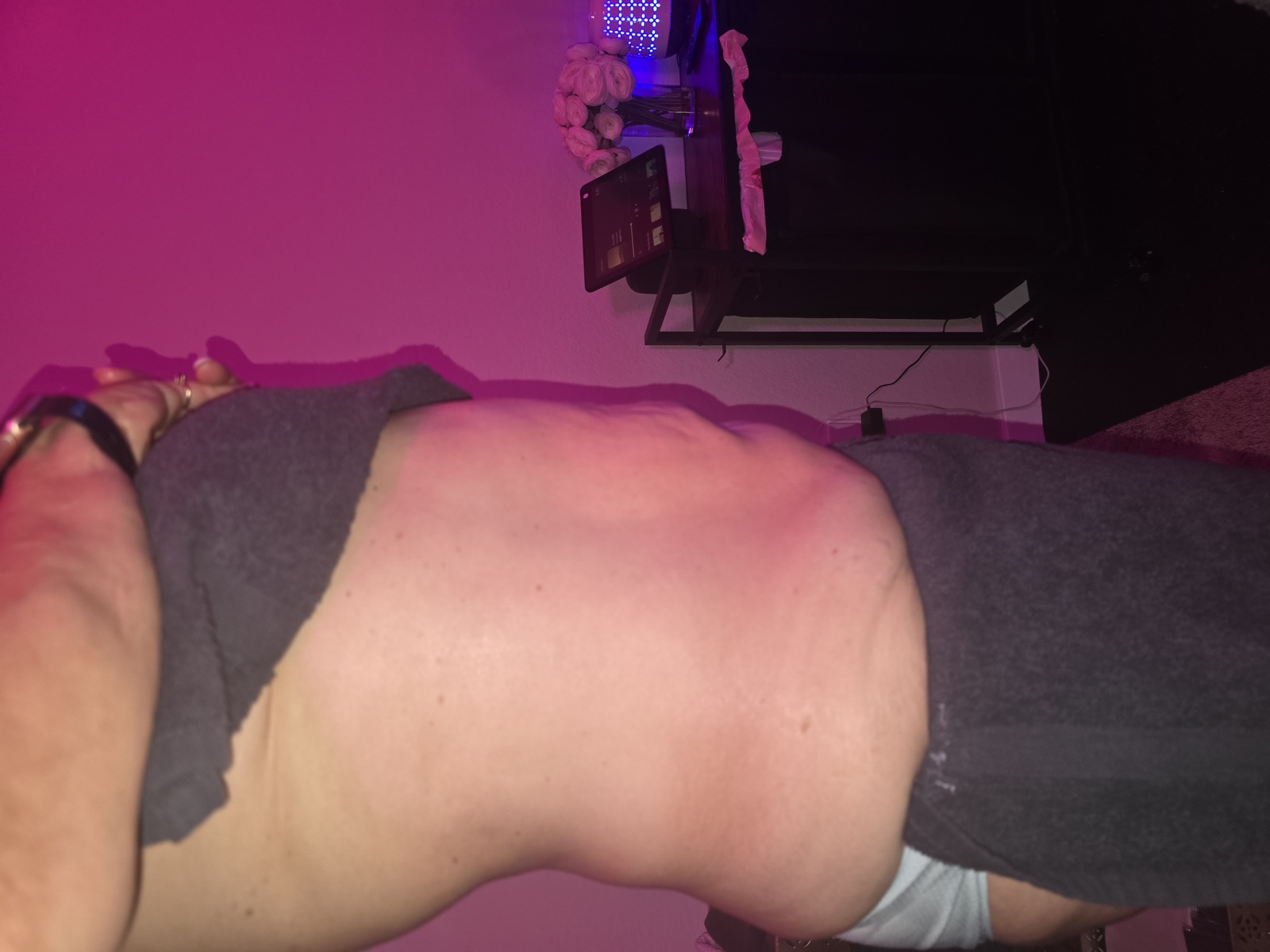 Stomach Reduction after treatment