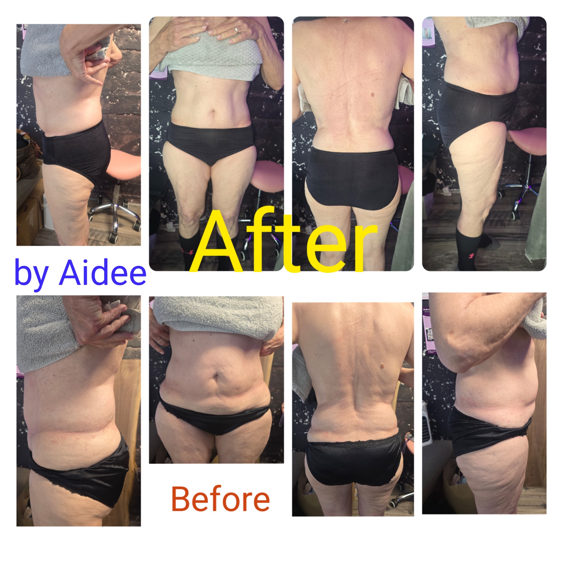 Holistic Body Sculpting