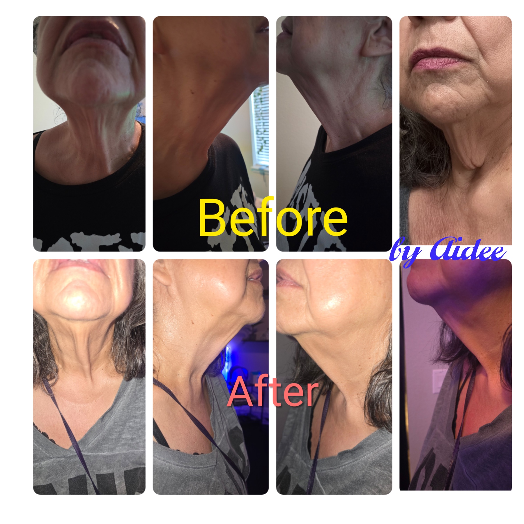 Holistic Body Sculpting