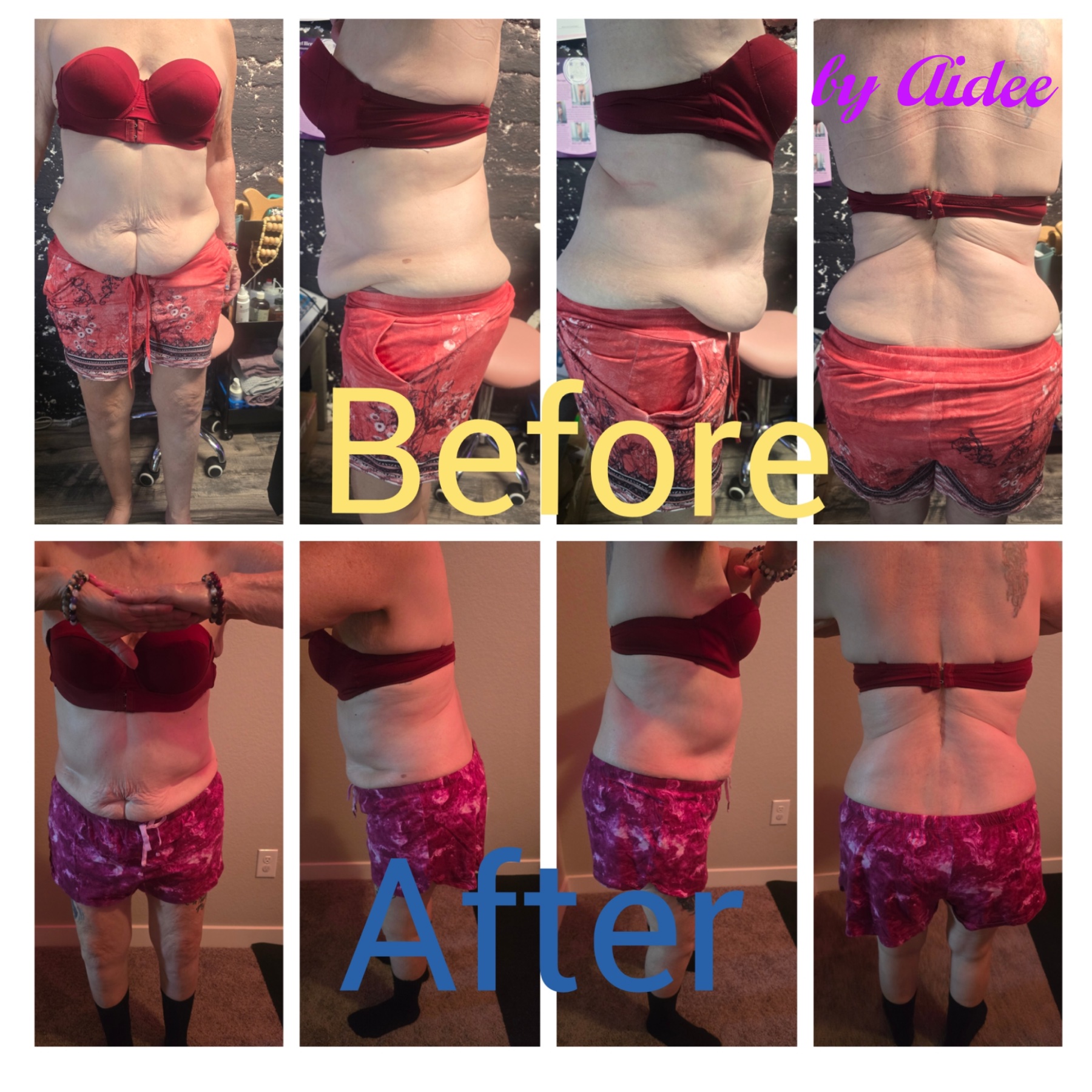 Holistic Body Sculpting