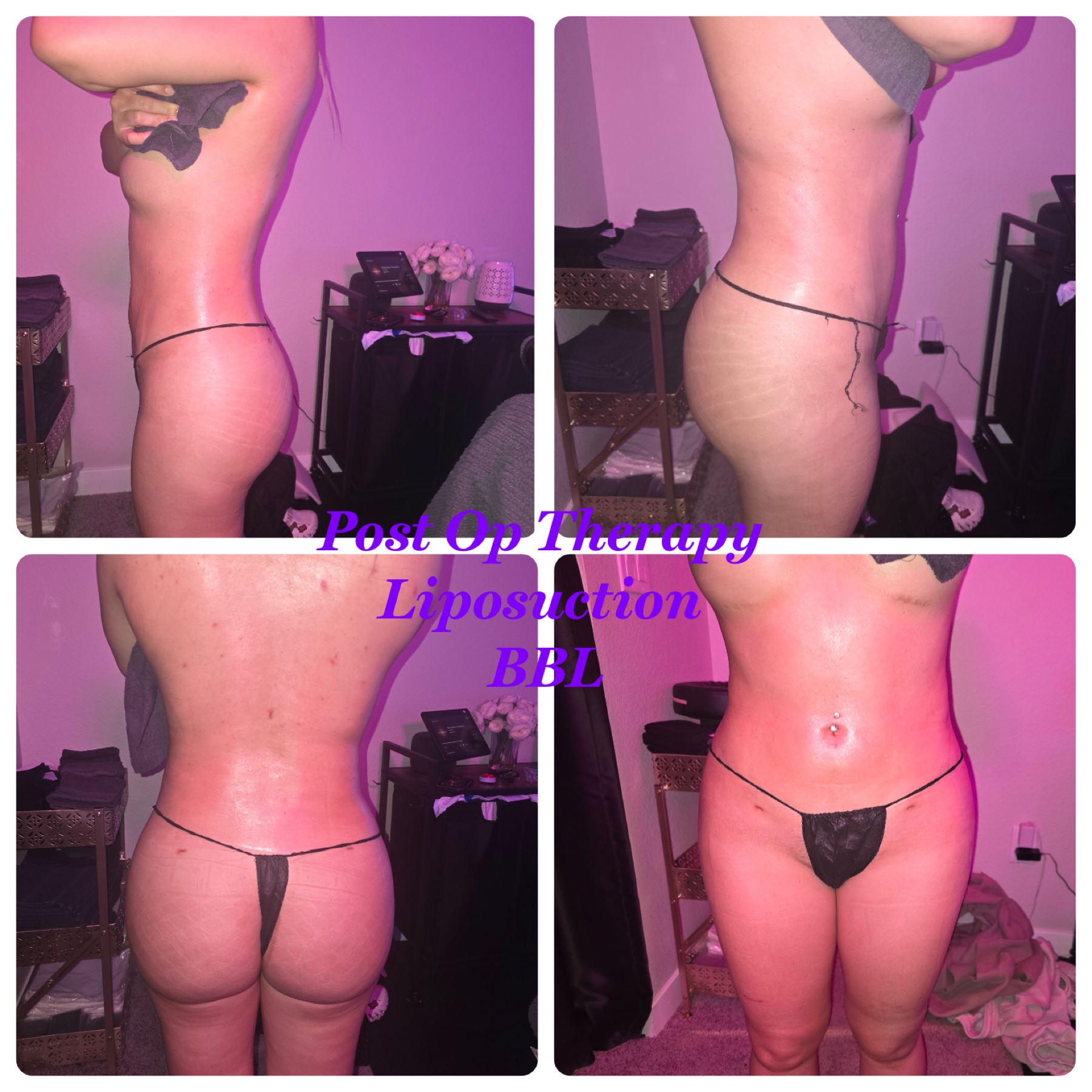 Post-Op Therapy · Liposuction & BBL